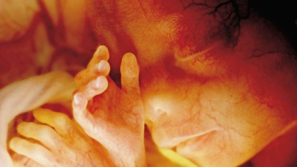 Akademie fordert neues Embryonenschutzgesetz: Unnötige Hürden bei Kinderwunsch?