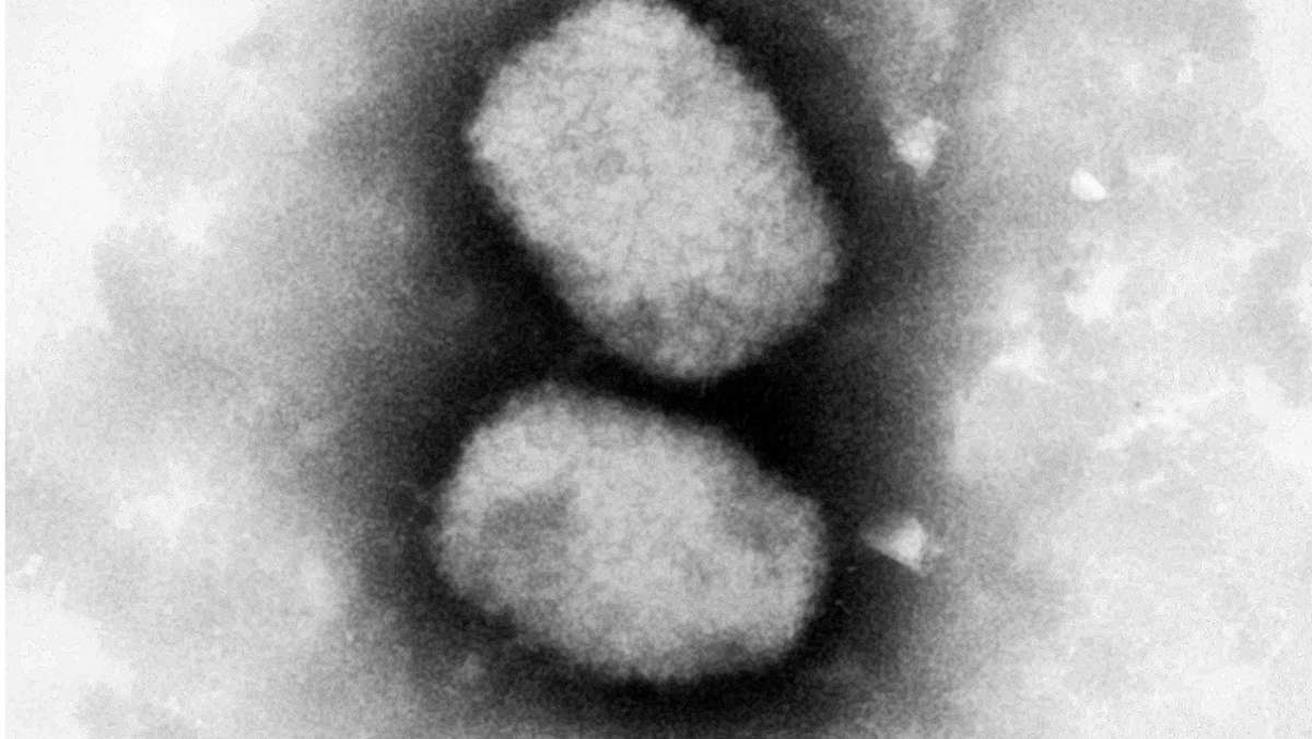 Affenpockenvirus: So gefährlich ist das Affenpockenvirus