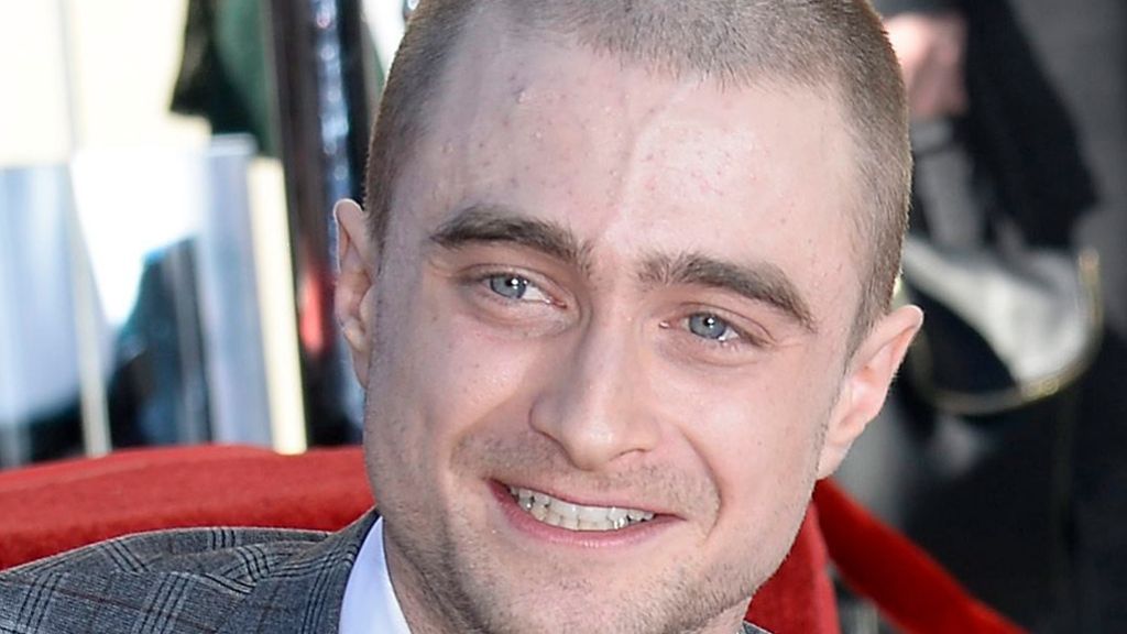 Harry-Potter-Star Daniel Radcliffe: „Vor Sexszenen muss ich kichern“