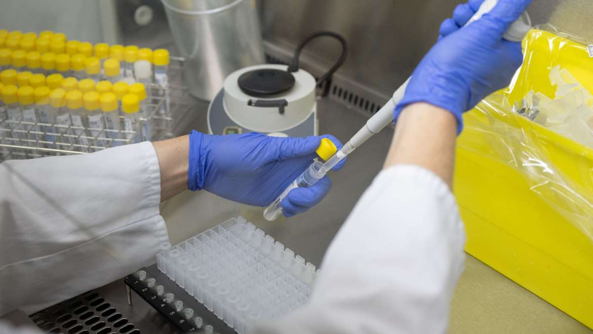 Wenn der Schnelltest positiv ist: Stadt Stuttgart empfiehlt zur Absicherung  einen PCR-Test