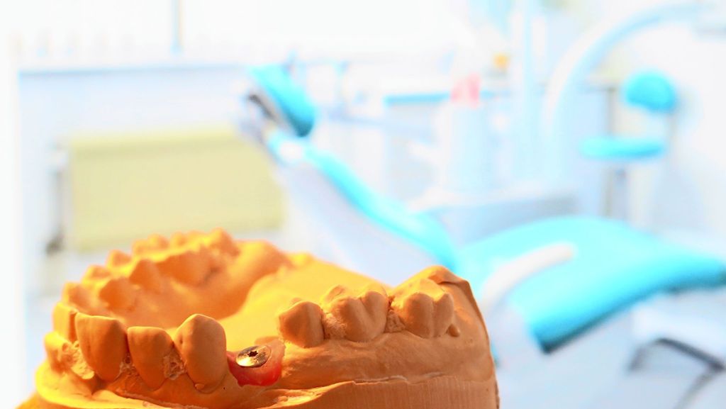 Zahnärzte in Fellbach: Schmerzpatienten bekommen weiterhin einen Termin
