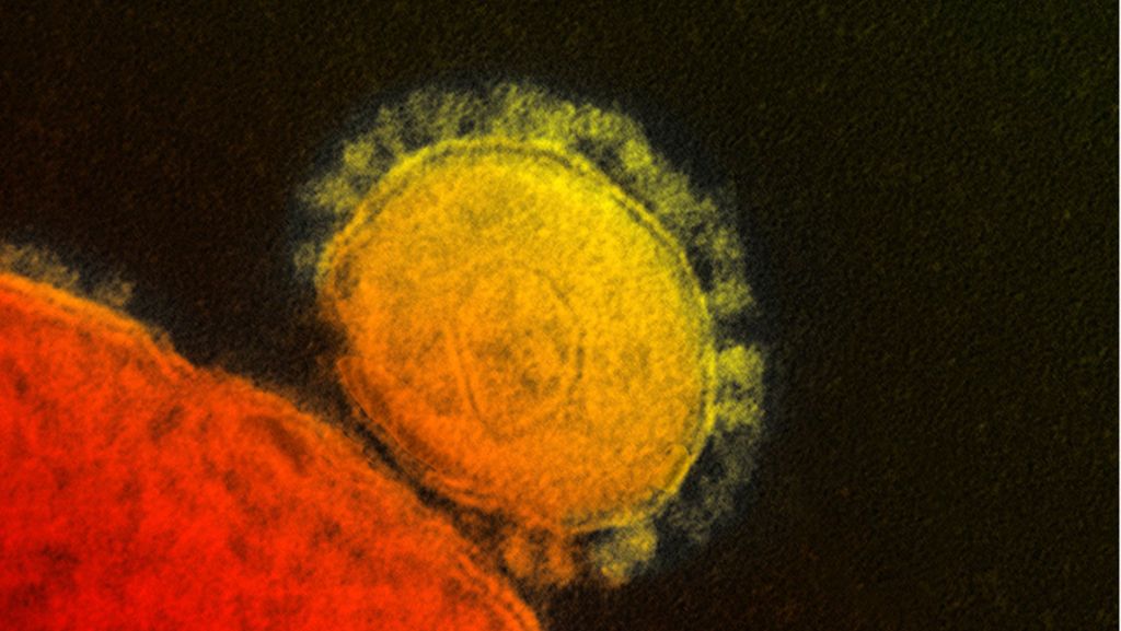 Neuartige Lungenkrankheit: Warum Viren so erfolgreich sind