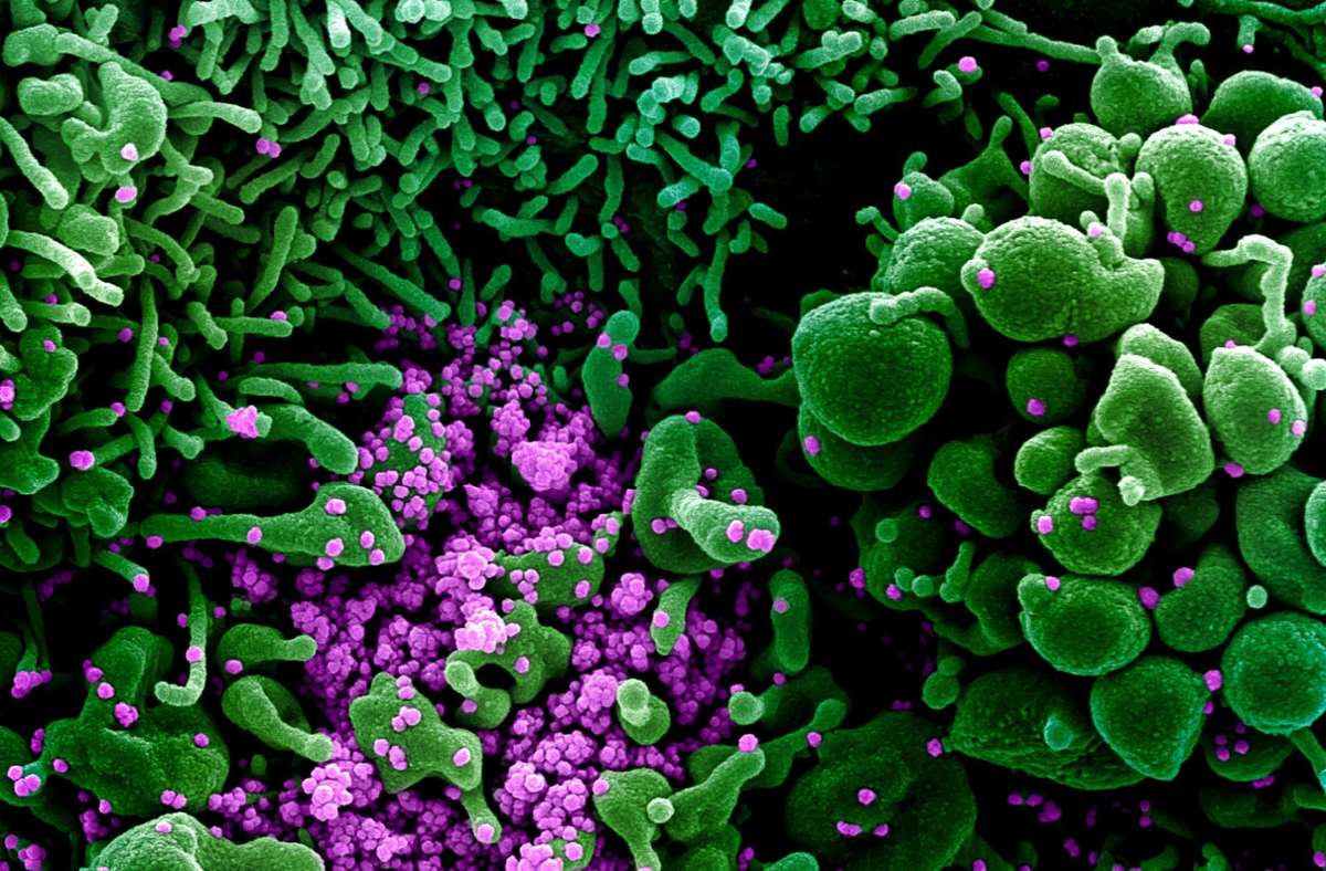 USA, Montana: Auf dieser vom US-Forschungszentrum „National Institute of Allergy and Infectious Diseases“ (NIAID) im US-Bundesstaat Montana zur Verfügung gestellten Aufnahme ist eine Zelle (grün) mit dem Coronavirus (SARS-CoV-2, violett) infiziert. Foto: Niaid/Europa Press/dpa