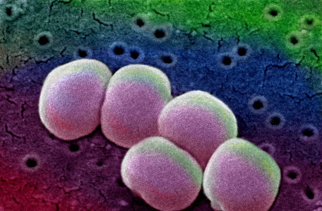 Das Bakterium Staphylococcus aureus lebt auf vielen Menschen. Gefährlich wird es, wenn es  Resistenzen gebildet hat und der Mensch immungeschwächt ist. Foto: medicalpicture/Frank Geißler
