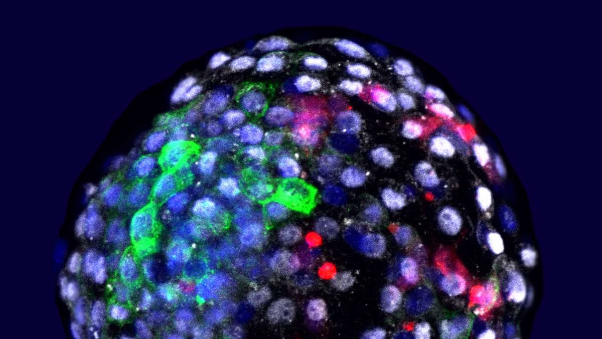 Mischwesen: Forscher erzeugen Embryonen aus Zellen von Mensch und Affe