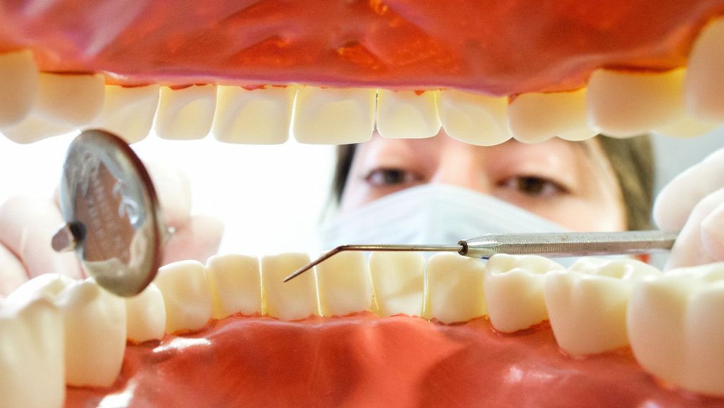 Von Spinat bis Smoothies: Auch Gesundes kann den Zähnen schaden