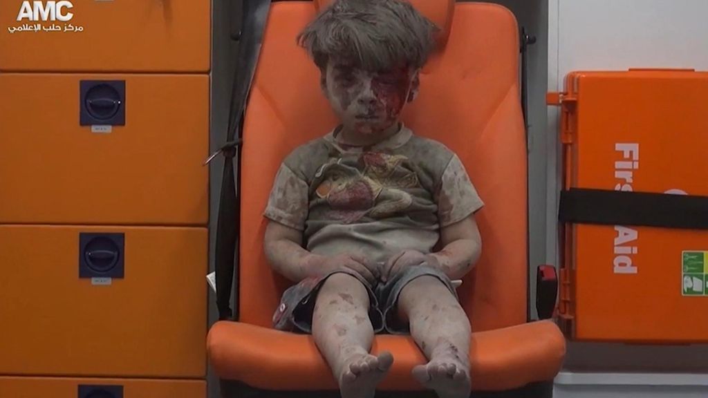 Aus Trümmern geretteter Junge: Dieses Foto wird zum Symbol des Kampfes um Aleppo