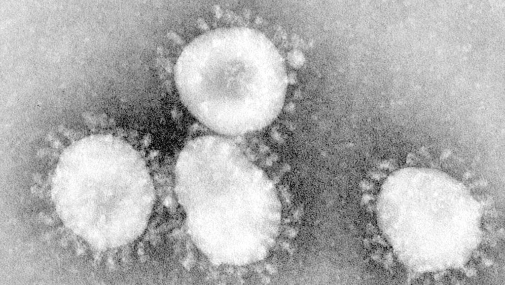 Coronavirus: Charité-Experte: Auch in Deutschland mit Fällen  zu rechnen