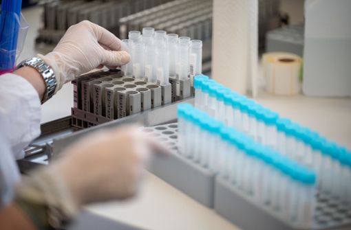 Intern werden die PCR-Tests beim Auswerten bereits priorisiert