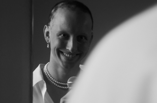 In seinem persönlichen Kurzfilm Die Angst vor dem Anderssein dokumentiert Jugendfilmpreisträger Jan Horvath seinen Alltag mit kreisrundem Haarausfall. Foto: Jan Horvath