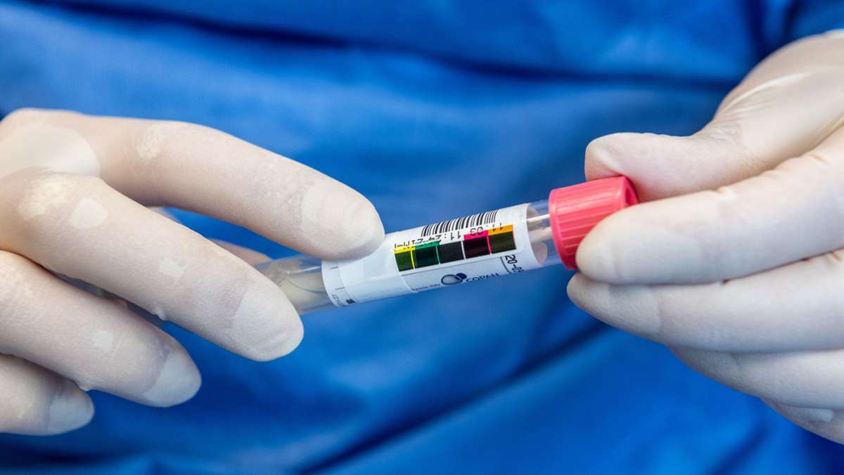 Coronavirus in Baden-Württemberg: 48 neue Infektionen gemeldet