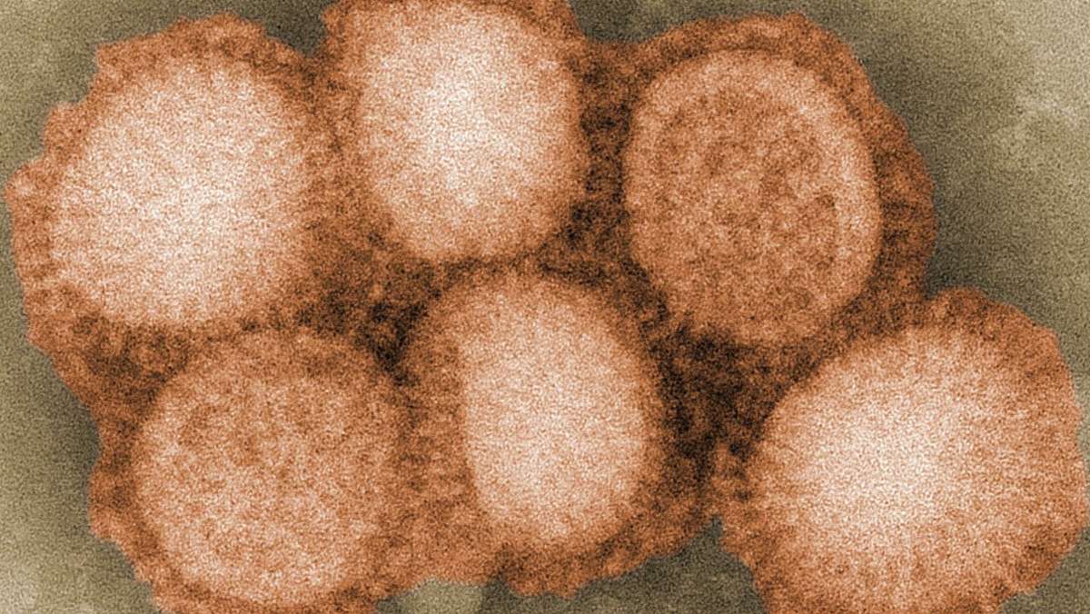  Drohen nach Sars-CoV-2 neue Pandemien- durch andere Corona- oder Influenza-Virenstämme? In Kanada hat sich jetzt ein Mensch mit einem Schweinegrippe-Virus angesteckt, der zu den Influenza-Viren gehört. 