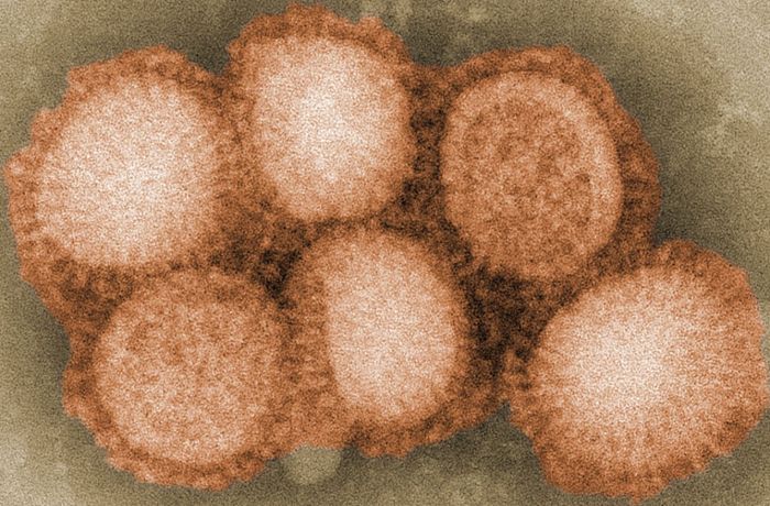 Seltener Fall von Schweinegrippe-Infektion beim Menschen