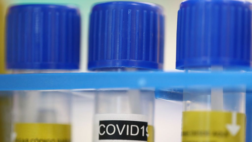  Schützt Nikotin vor einer Ansteckung mit dem neuartigen Coronavirus? – Zahlen sprechen dafür, französische Wissenschaftler untersuchen die Annahme. 