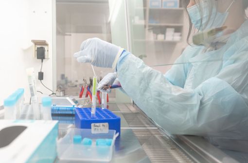 Union fordert Priorisierung bei Auswertung von PCR-Tests