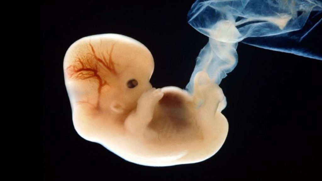Japan erlaubt Mischwesen aus Mensch und Tier: Umstrittenes Embryonen-Experiment genehmigt
