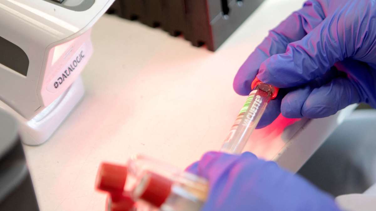 Corona-Pandemie: Land will mehr PCR-Tests in Apotheken