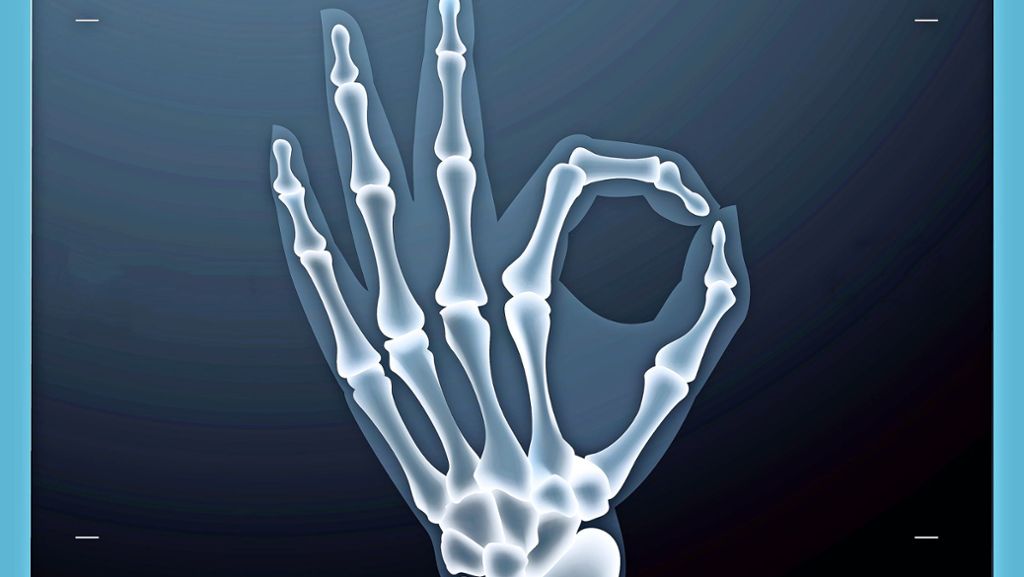 Röntgen: „Strahlung vermeiden, die nicht nötig ist“