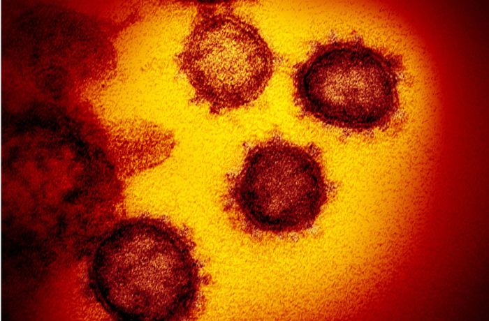 Feindliche Übernahme – So zerstört  das Coronavirus  menschliche Zellen